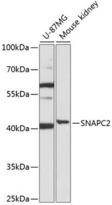 Western Blot: SNAP45 Antibody [NBP2-93703] - Western blot analysis of extracts of various cell lines, using SNAP45 antibody (NBP2-93703) at 1:1000 dilution. Secondary antibody: HRP Goat Anti-Rabbit IgG (H+L) at 1:10000 dilution. Lysates/proteins: 25ug per lane. Blocking buffer: 3% nonfat dry milk in TBST. Detection: ECL Basic Kit. Exposure time: 30s.